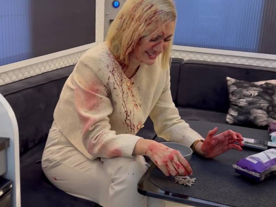 Bergüzar Korel'in kanlı paylaşımı takipçilerini korkuttu! Neden paylaştığı daha sonra ortaya çıktı 12